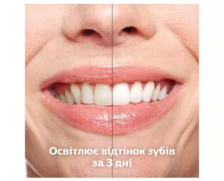 Зубная электрощетка PHILIPS Sonicare DiamondClean 9000 HX9911/94